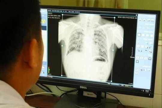 Nghệ An: Thêm hàng chục người được xác định mắc bệnh bụi phổi