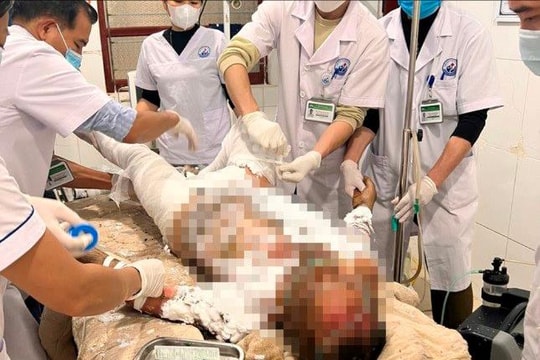 Mâu thuẫn với vợ, người đàn ông tẩm xăng tự thiêu