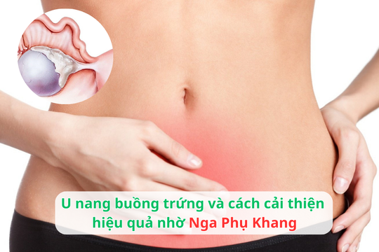 U nang buồng trứng và cách cải thiện hiệu quả nhờ Nga Phụ Khang