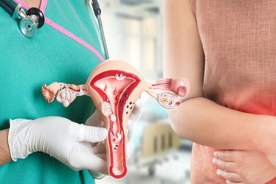 Chi phí khám sàng lọc ung thư cổ tử cung được đề xuất bảo hiểm y tế chi trả