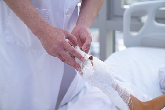Lên mạng học tự chế pháo nổ, nam sinh bị dập nát bàn tay