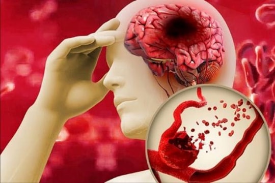 Gia tăng các bệnh lý nguy hiểm trong thời tiết rét đậm