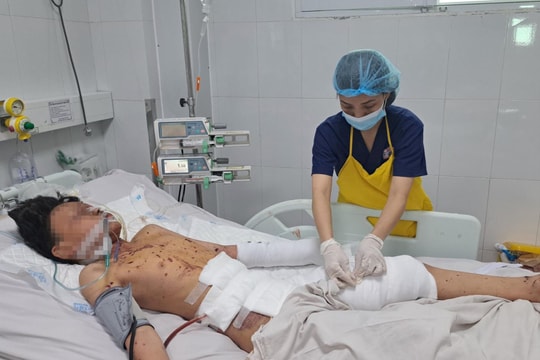 Thêm trường hợp đa chấn thương nặng do pháo nổ