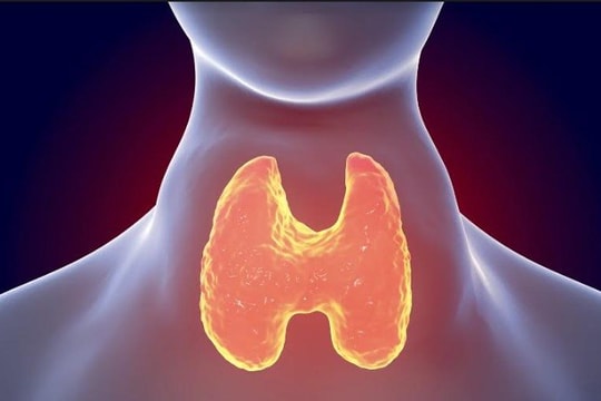 Tất tần tật về bệnh cường giáp Basedow và cách cải thiện từ Ích Giáp Vương