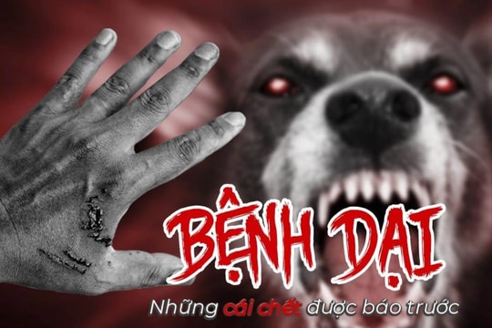 Bệnh nhi tử vong do bệnh dại sau khi bị chó nhà cắn