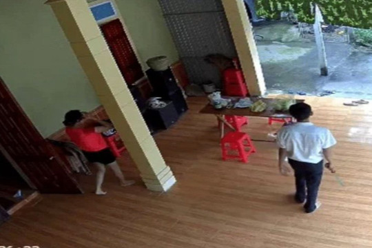 Nghệ An: Người phụ nữ bị chồng bạo hành dã man