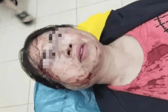 Chồng kém 11 tuổi nhốt vợ vào phòng đánh đập dã man