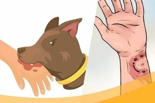 Triển khai các biện pháp cấp bách phòng, chống bệnh dại