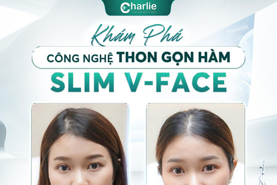 Thon gọn hàm không phẫu thuật tại phòng khám Charlie có được vĩnh viễn không?