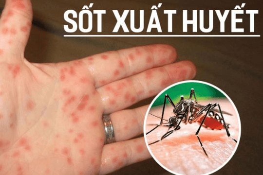 Gia tăng số ca mắc sốt xuất huyết tại Hà Nội