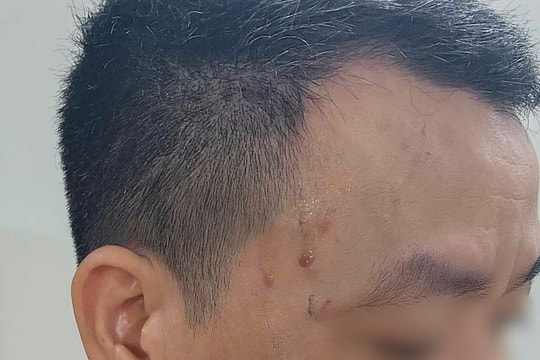 Chủ tịch UBND TP. Hà Nội yêu cầu làm rõ vụ 2 phóng viên bị hành hung