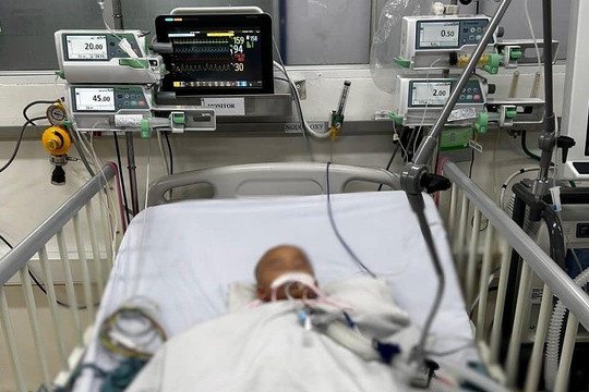 Bé 10 tháng tuổi bị amip ăn não