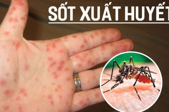 Hà Nội thêm nhiều ca sốt xuất huyết và ho gà
