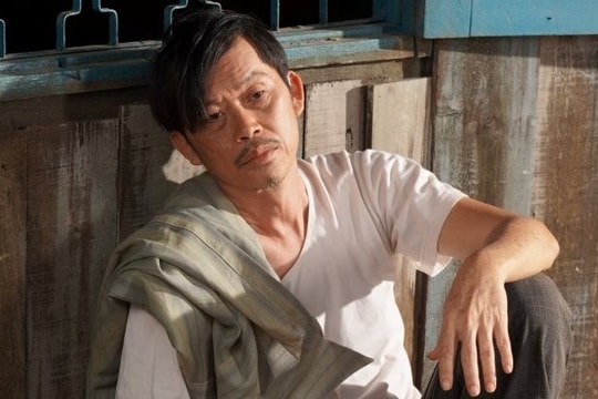 Hoài Linh tiết lộ bị ung thư tuyến giáp di căn