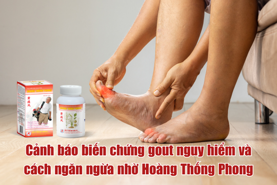 Cảnh báo biến chứng gout nguy hiểm và cách ngăn ngừa nhờ Hoàng Thống Phong