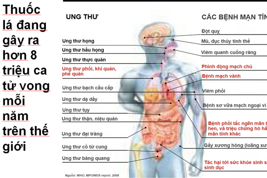Thuốc lá là nguyên nhân hàng đầu gây ra bệnh tật và tử vong sớm