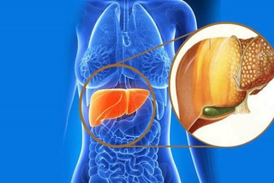 Phát hiện phương pháp mới đẩy lùi gan nhiễm mỡ