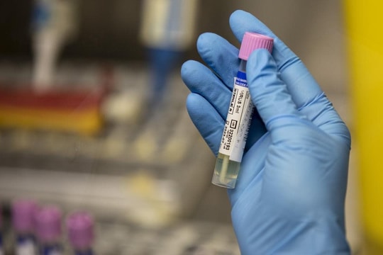 Hơn 300 lọ virus sống cực kỳ nguy hiểm bị mất cách đây 3 năm