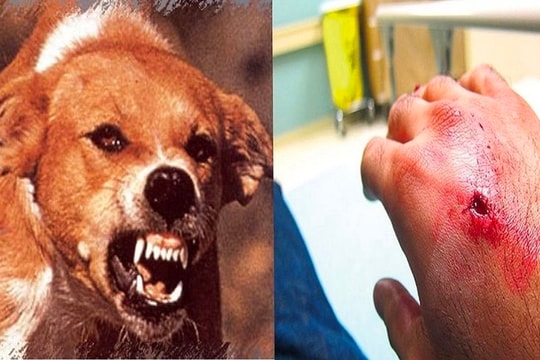 Gia Lai: Thêm hai trường hợp tử vong do bệnh dại