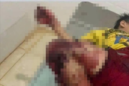 Gia Lai: Tự chế tạo pháo nổ tại nhà, 4 học sinh nhập viện