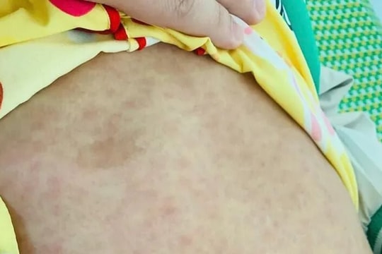 Làm rõ nguyên nhân 3 trẻ tử vong tại huyện vùng núi Nam Trà My