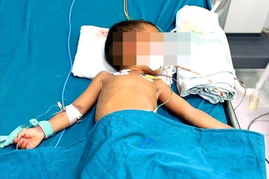 Bé trai 4 tuổi bị rắn cắn phải nhập viện