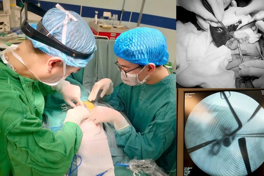 Phú Thọ: Phẫu thuật thành công teo mật bẩm sinh cho bé gái 1 tháng tuổi