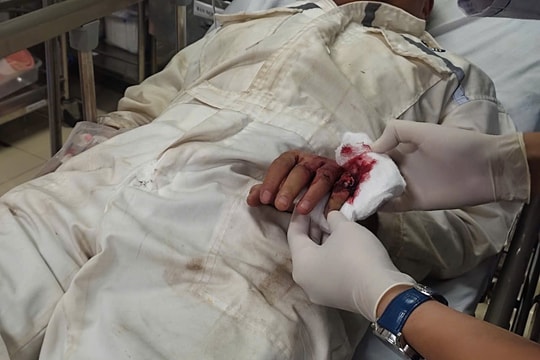 Nối thành công ngón tay của người nước ngoài bị đứt lìa