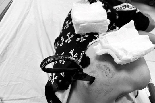 Xôn xao đoạn clip thanh niên dùng kéo đâm người trên đường