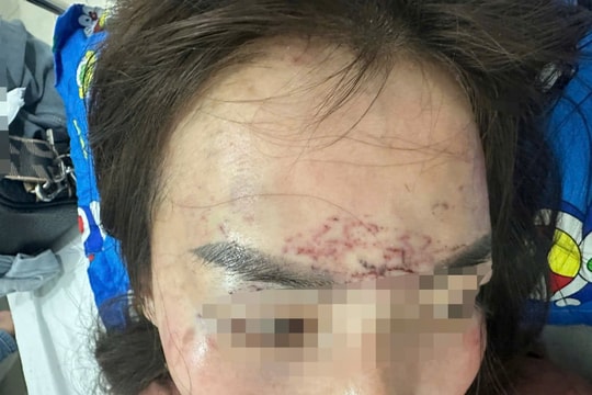 Công an vào cuộc làm rõ vụ người phụ nữ bị hành hung ở Cà Mau