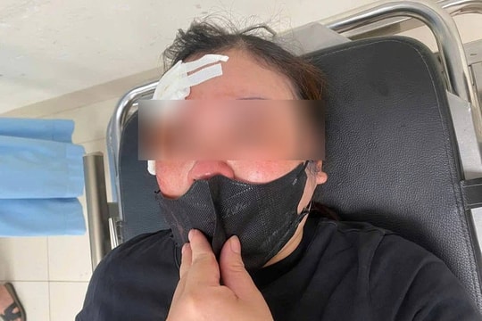 Triệu tập người ngồi trên xe bán tải dùng dùi cui vụt vào đầu người đi đường