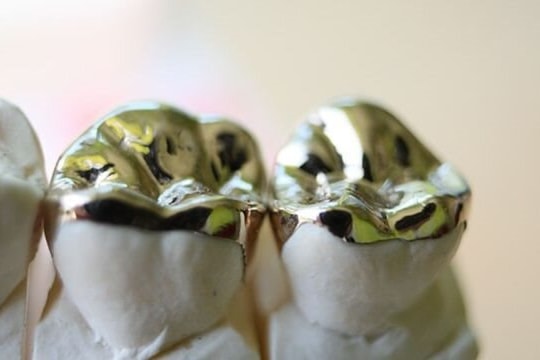 Người đàn ông thu gom răng vàng của người chết, nấu được thỏi vàng 1.800 USD