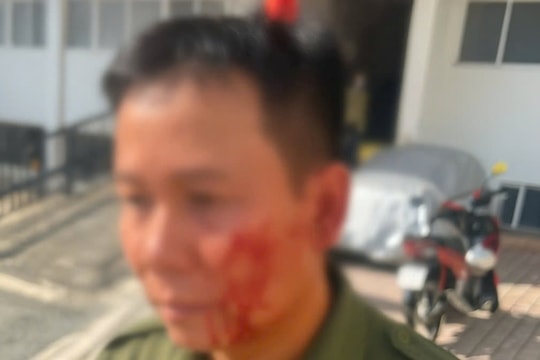 Cố thủ bằng dao rồi gây thương tích cho lực lượng an ninh