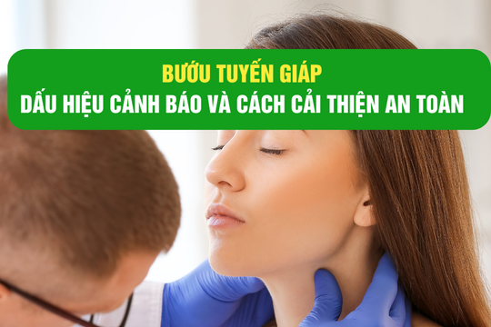 Bướu tuyến giáp: Dấu hiệu cảnh báo và cách hỗ trợ cải thiện an toàn