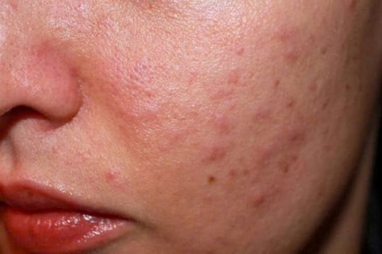 Hệ lụy khôn lường khi mỹ phẩm giả tung hoành thị trường