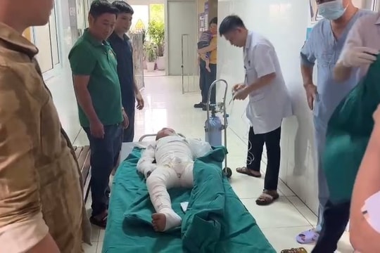 Dùng xăng đốt kiến, 2 trẻ bị bỏng nặng