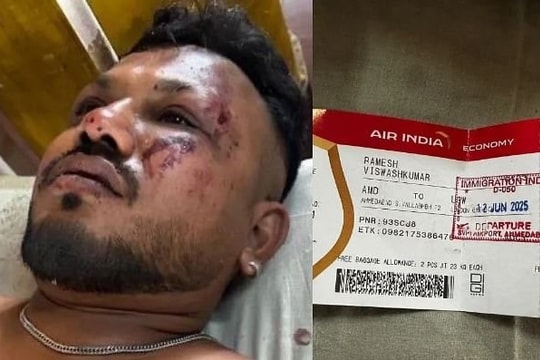 Tai nạn máy bay thảm khốc ở Ấn Độ: Duy nhất một người ngồi ghế 11A sống sót thần kỳ