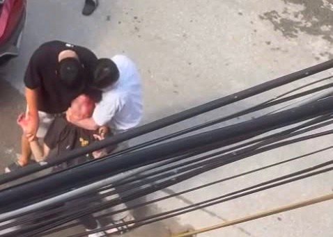 Nam thanh niên bị đánh chảy máu đầu sau khi được hỏi “mày biết tao là ai không?”