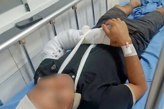 Điều tra vụ việc tài xế xe cứu hộ giao thông bị đánh gãy tay