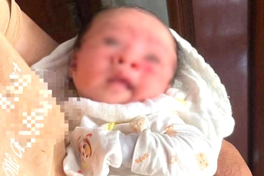 Nghệ An: Bé gái 20 ngày tuổi bị bỏ rơi bên đường