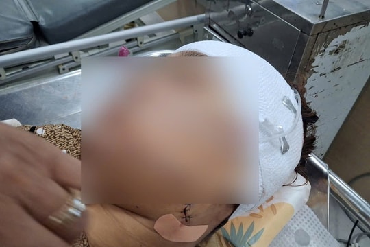 Làm rõ vụ dùng dao rọc giấy để đánh ghen