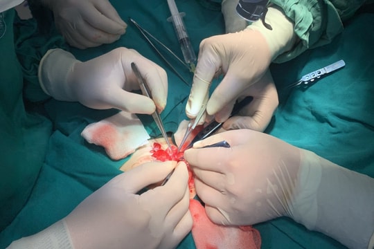 Nối thành công dương vật đứt rời cho bé trai 9 tuổi