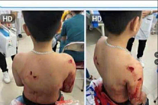 Cộng đồng mạng "bức xúc" trước hình ảnh cháu bé bị hành hung rồi hất xuống hồ nước
