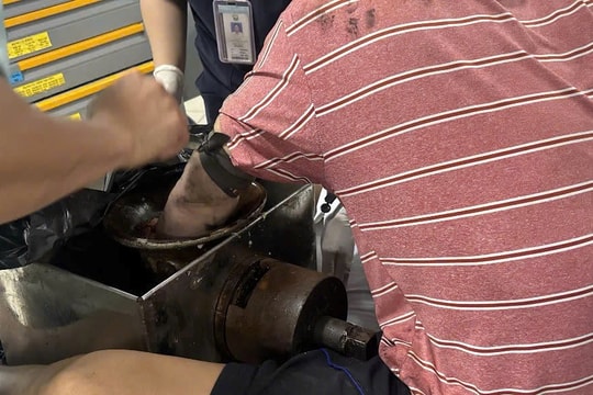 Bị cuốn nát bàn tay khi vệ sinh máy xay thịt