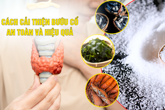 Cách cải thiện bướu cổ đơn thuần an toàn và hiệu quả