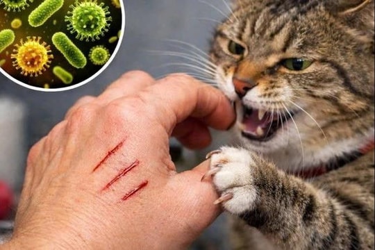 Bị chó, mèo cắn nhẹ có cần tiêm vắc xin dại?