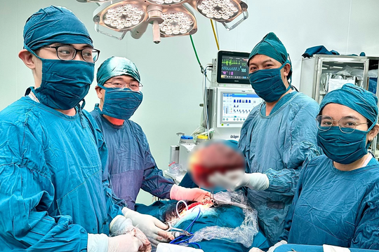 Cắt khối bướu diệp thể vú nặng gần 4kg cho một bệnh nhân nữ
