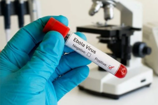 Bộ Y tế chỉ đạo khẩn về phòng chống dịch do virus Ebola