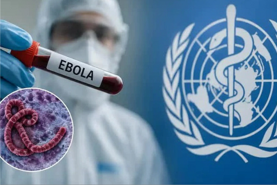 Những dấu hiệu nghi mắc Ebola người dân cần đặc biệt lưu ý