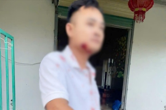 Khởi tố nhóm đối tượng dùng súng bắn người vay nợ ở Hà Tĩnh